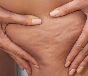 PARLONS CELLULITE LES FILLES !! conseil cellulite, astuces femme pour cellulite